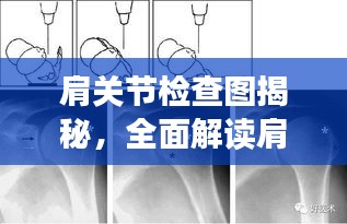 肩关节检查图揭秘，全面解读肩关节健康与功能状态